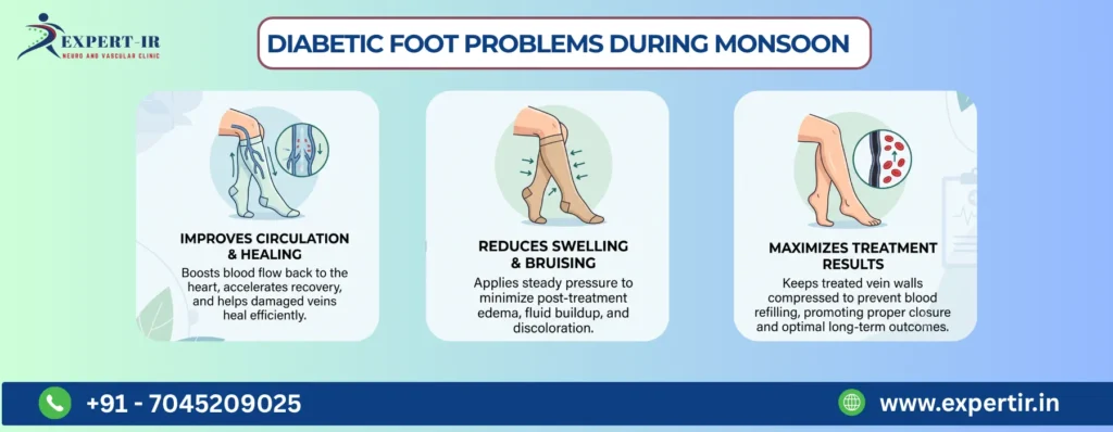 Why Compression Stockings Are Important After Sclerotherapy