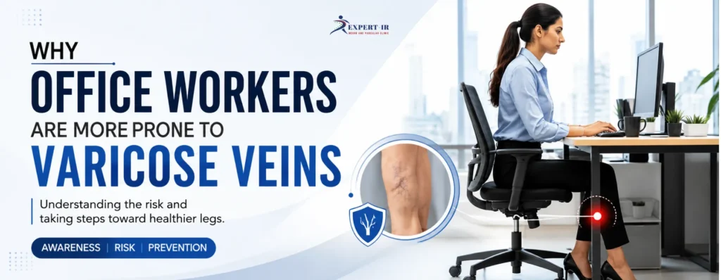 Why Office Workers Are More Prone to Varicose Veins