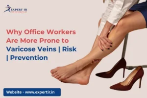 varicose veins and office work connection