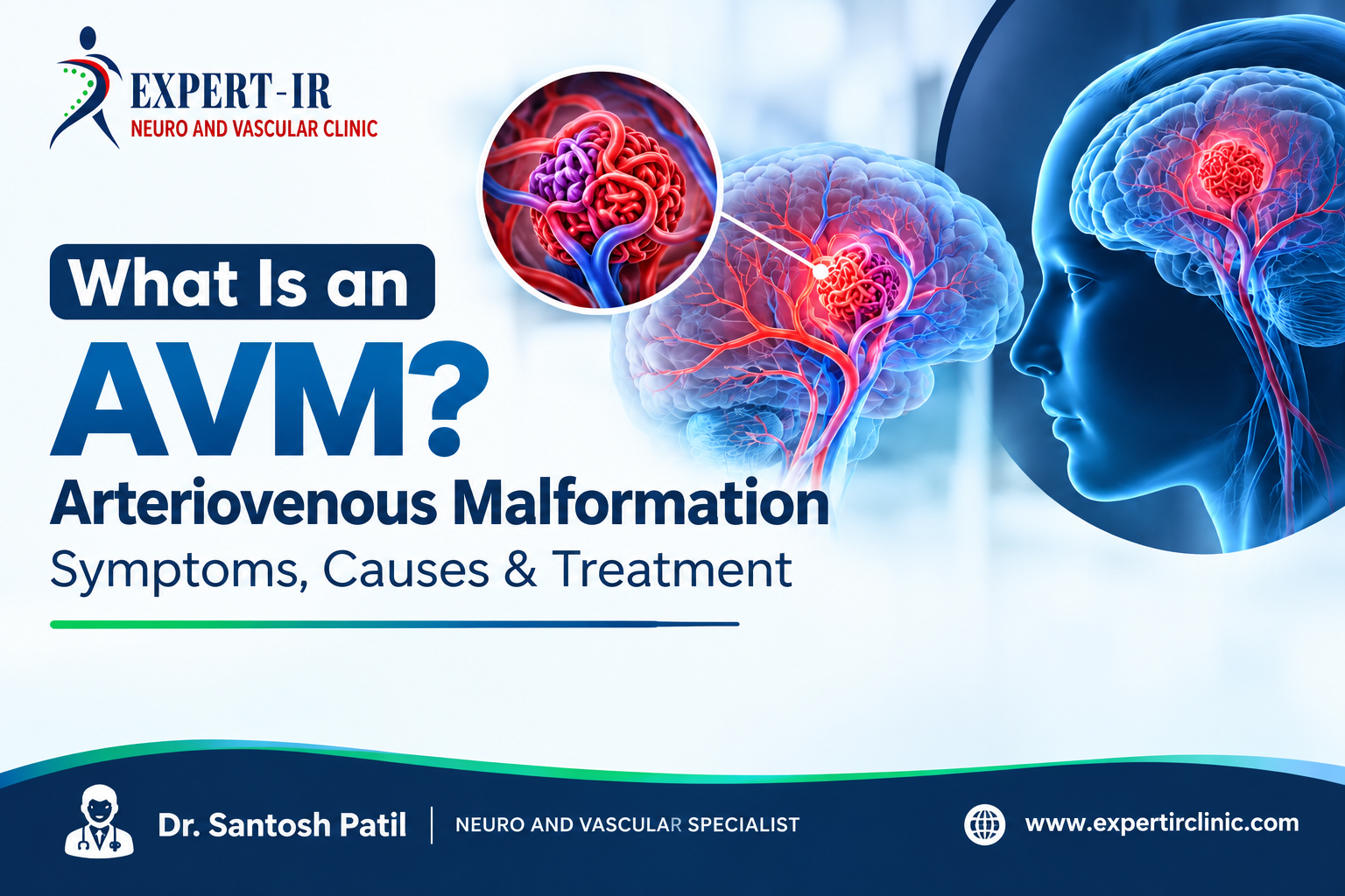 AVM