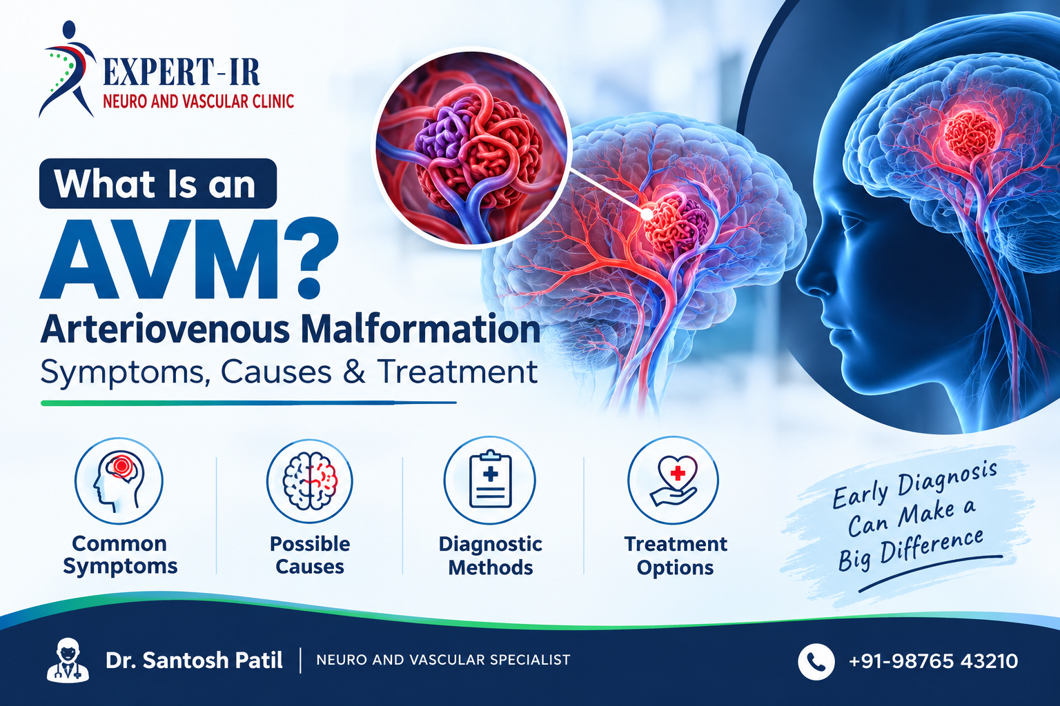 AVM