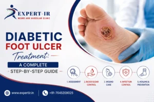 Diabetic Foot Ulcer Treatment in Pune