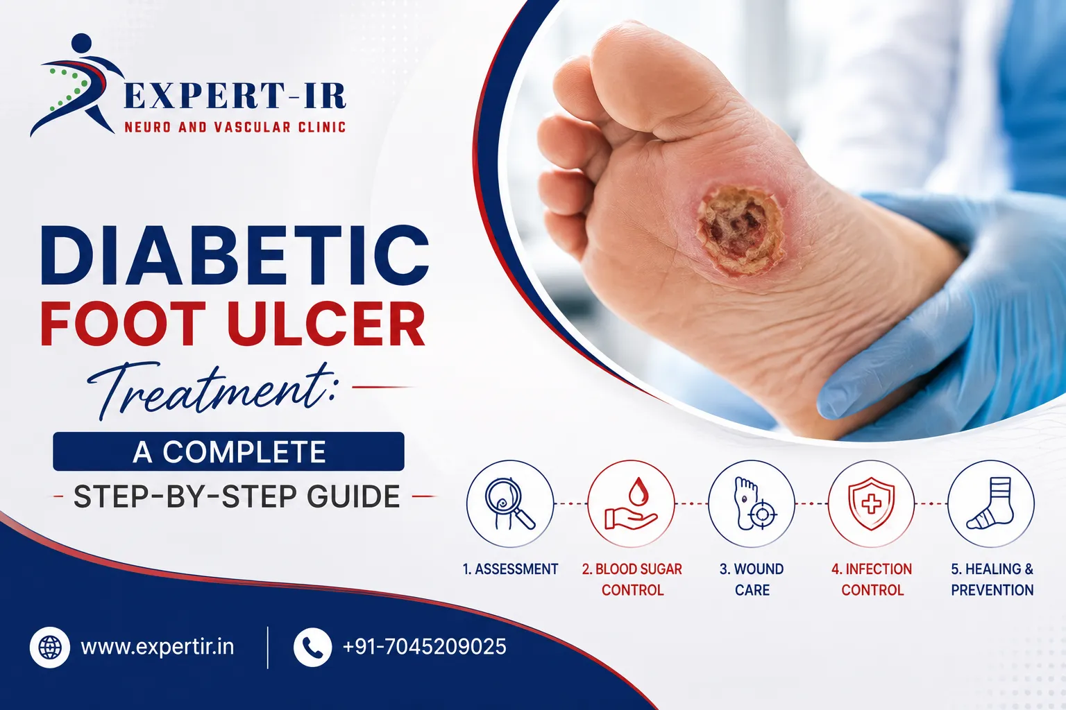 Diabetic Foot Ulcer Treatment in Pune