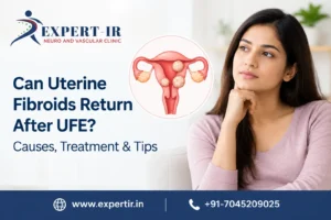 Can Uterine Fibroids Return After UFE Treatment?