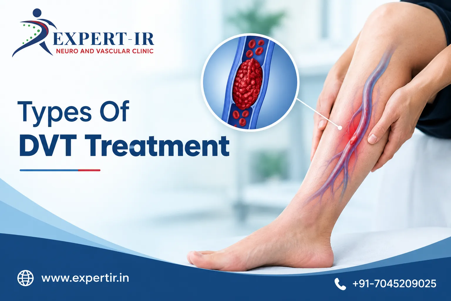 DVT Treatment in Pune, Diagnosis, Treatment Options and Recovery