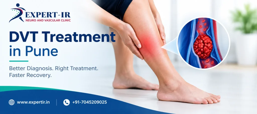 DVT Treatment in Pune