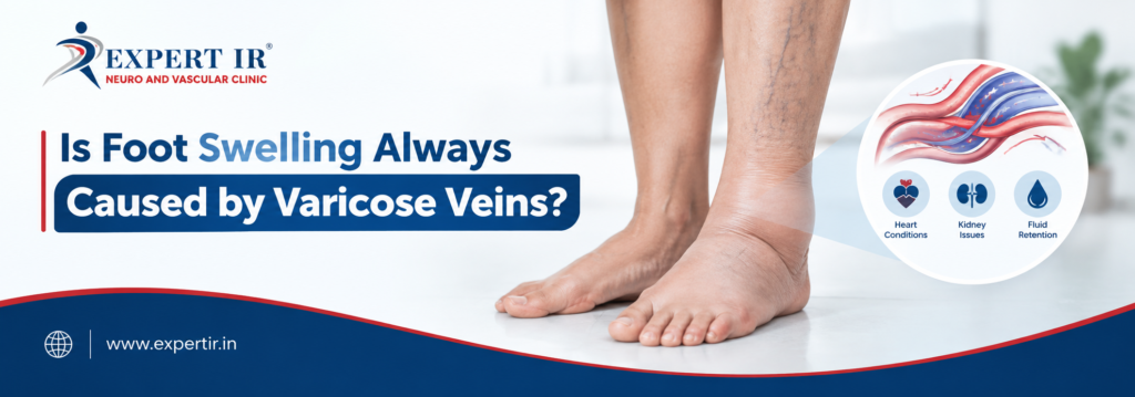 Foot Swelling Causes