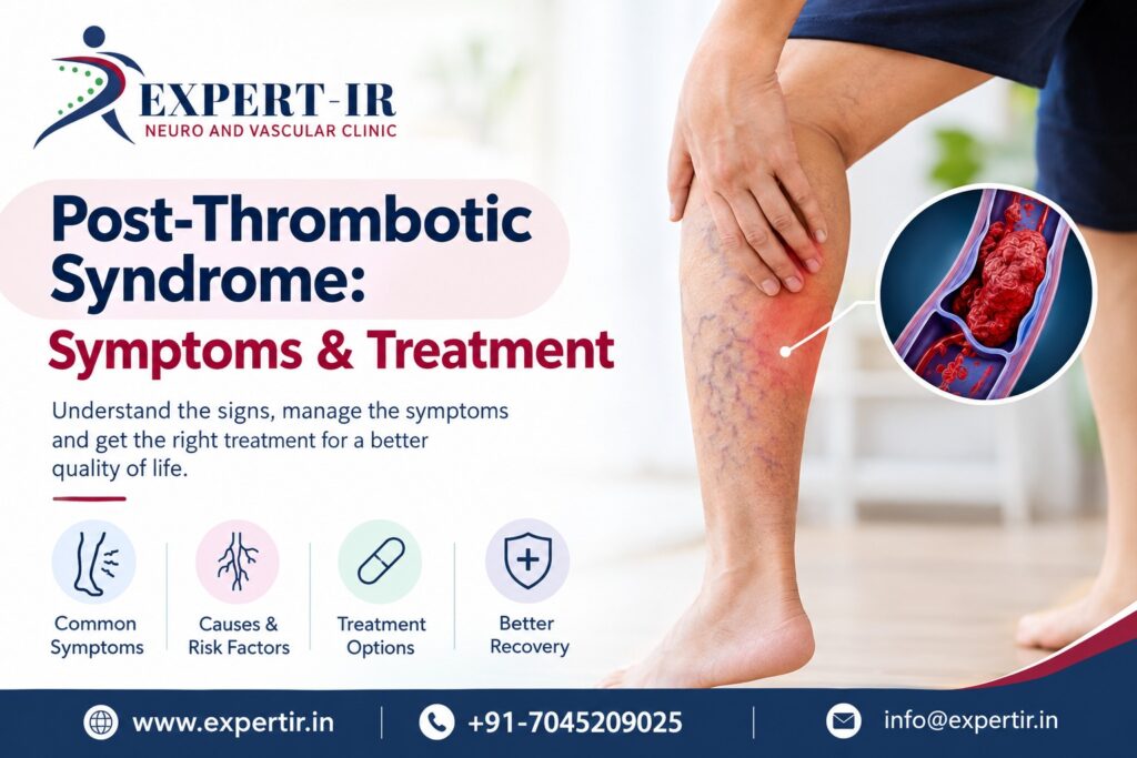 Thrombotic Syndrome