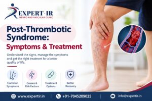 Thrombotic Syndrome