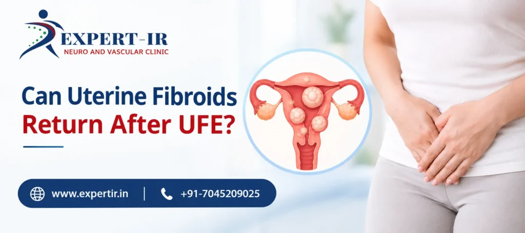 Can Uterine Fibroids Return After UFE Treatment?