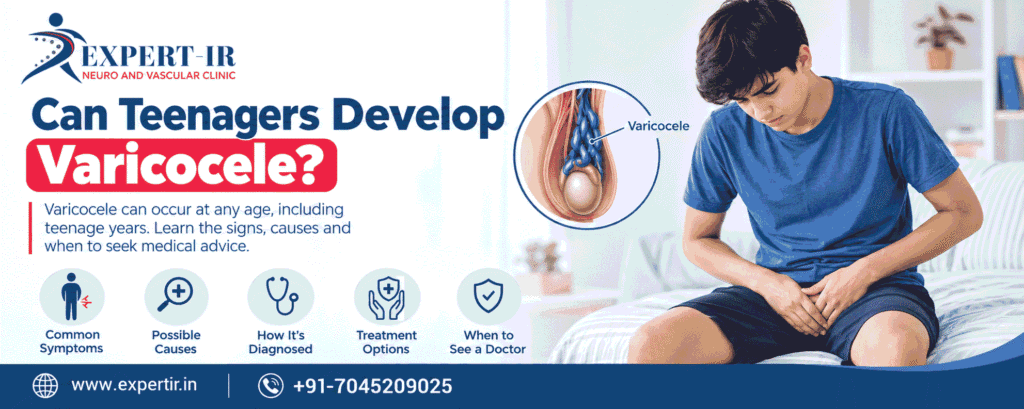 Teenagers Varicocele treatment options for enlarged scrotal veins Copy