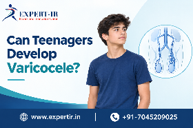 Varicocele treatment options for enlarged veins in the scrotum